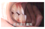 矯正治療前写真g3