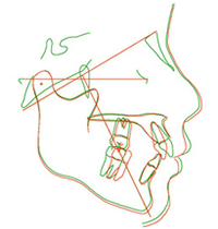 治療計画のライン図