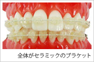 全体がセラミック
