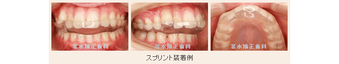 スプリント