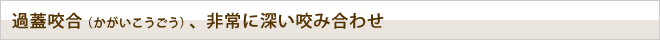 過蓋咬合（かがいこうごう）、非常に深い咬み合わせ